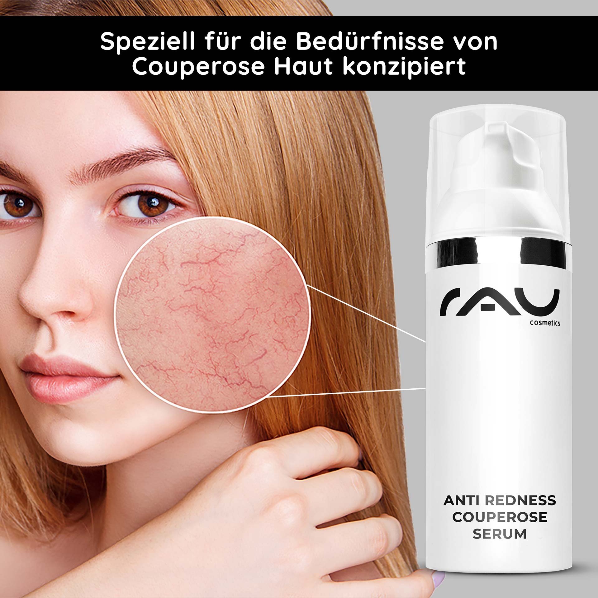 Frau mit blonder Haar und betontem roten Hautbereich, RAU Cosmetics Anti Redness Couperose Serum im Vordergrund, speziell für Couperose-Haut entwickelt.