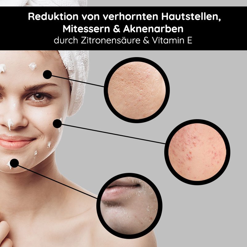 Frau mit Gesichtsmaske, die Hautpflege und Reduktion von Mitessern und Aknenarben durch Zitronensäure und Vitamin E zeigt, mit Hautvergrößerungen zur Veranschaulichung der Ergebnisse.