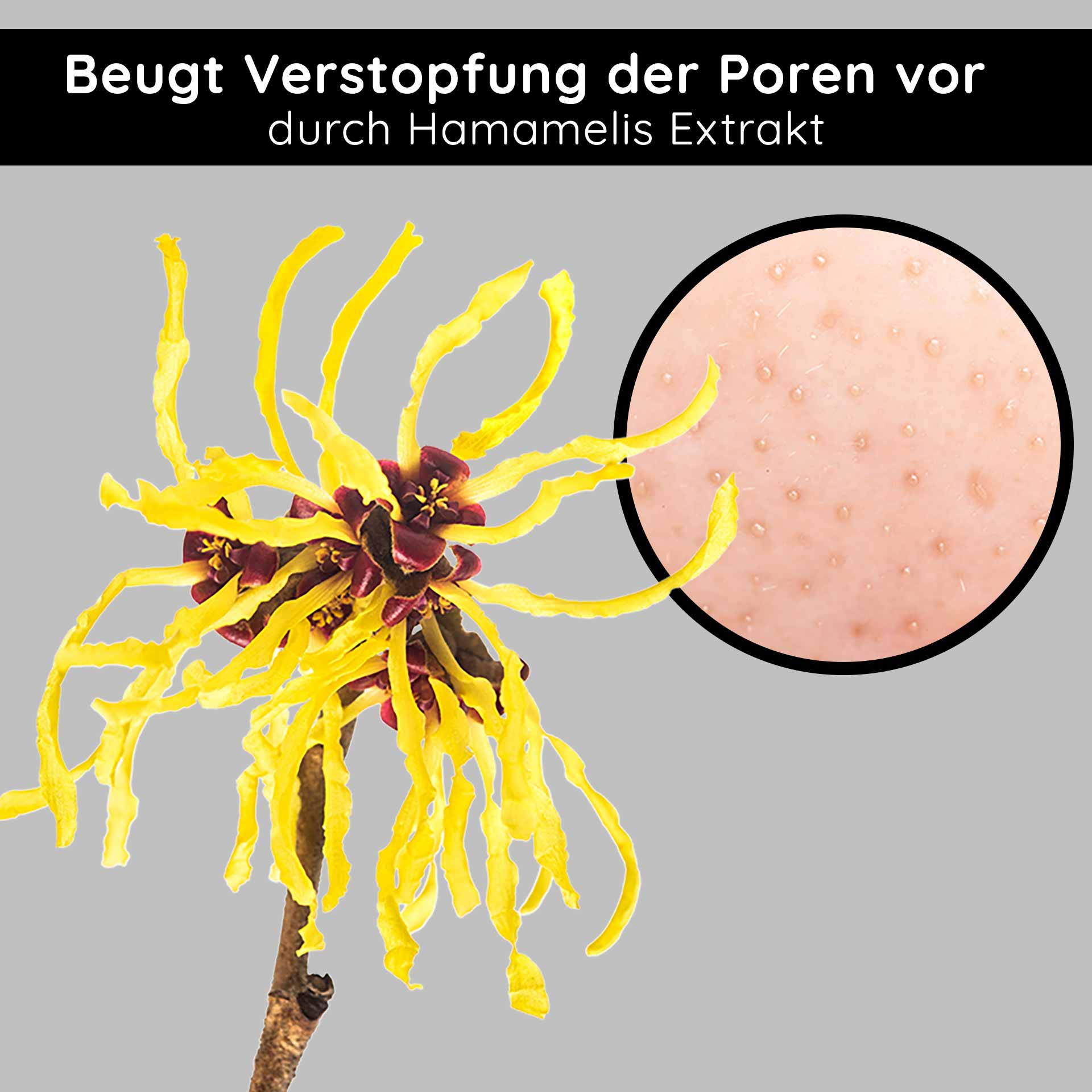 Powerset für unreine Haut, fettige Haut, Entzündungen, Pickel, Juckreiz /46/0d/90/1677073