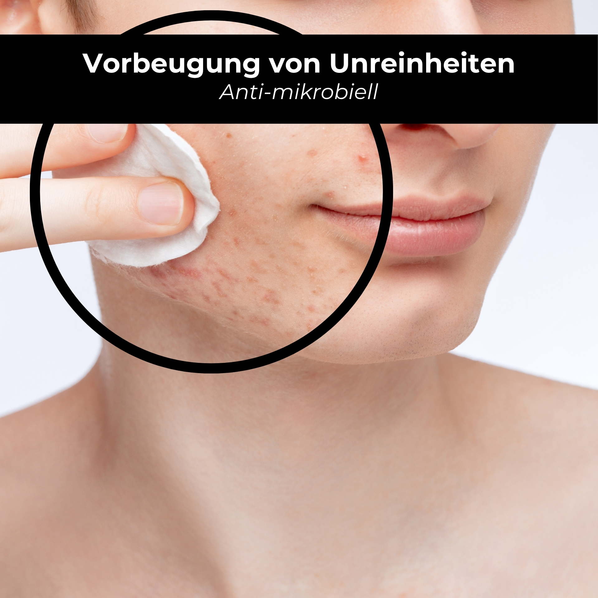 Purifying Tonic with alcohol 200 ml against impure skin Kopf, Person, Gesicht, Hals, Frau