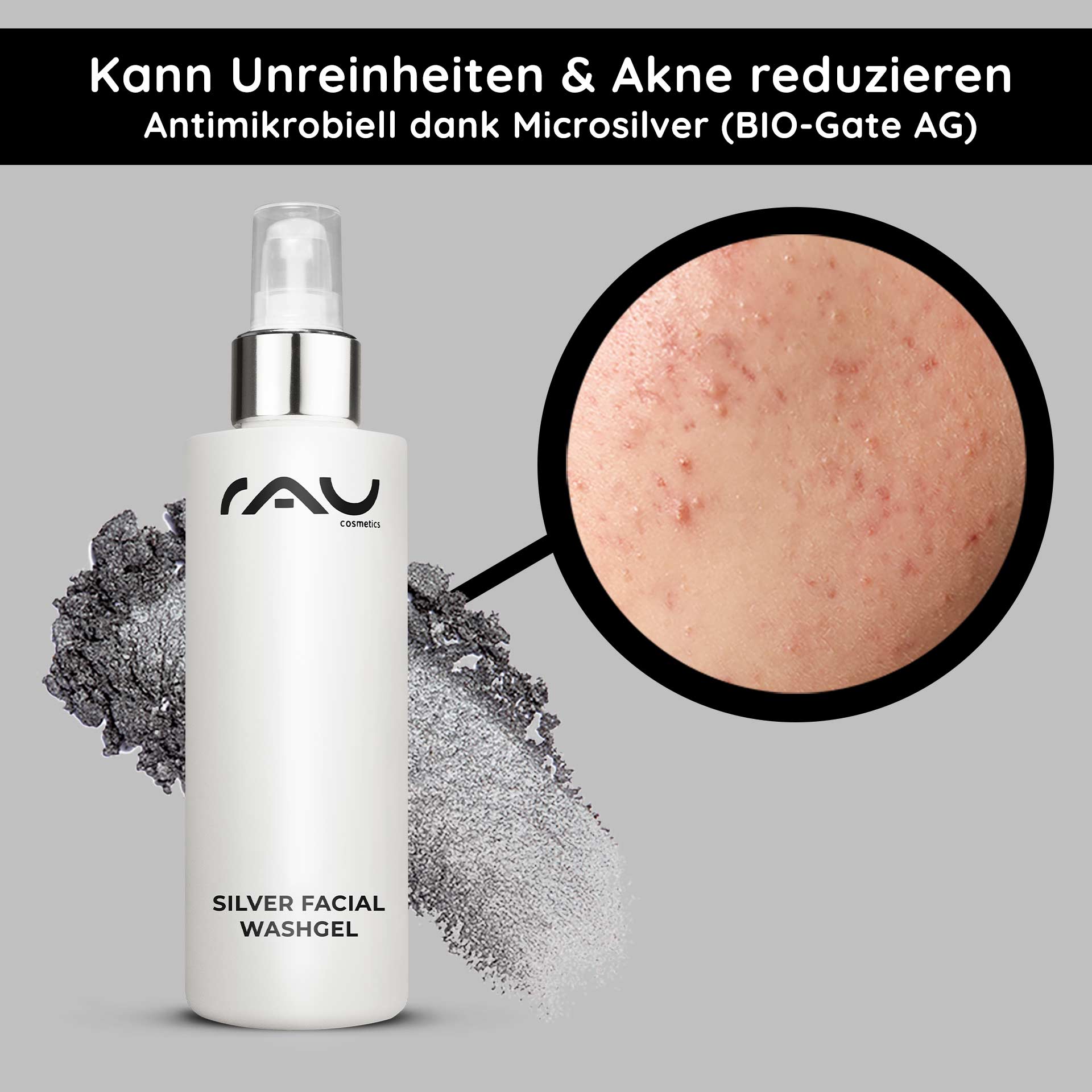 Silver Facial Washgel 200 ml Microsilver Cleanser Flasche RAU Silver Facial Washgel mit antimikrobiellem Mikrosilber, Nahaufnahme von Haut mit Akne und Unreinheiten, mit Hervorhebung der Vorteile für empfindliche und zu Akne neigende Haut.