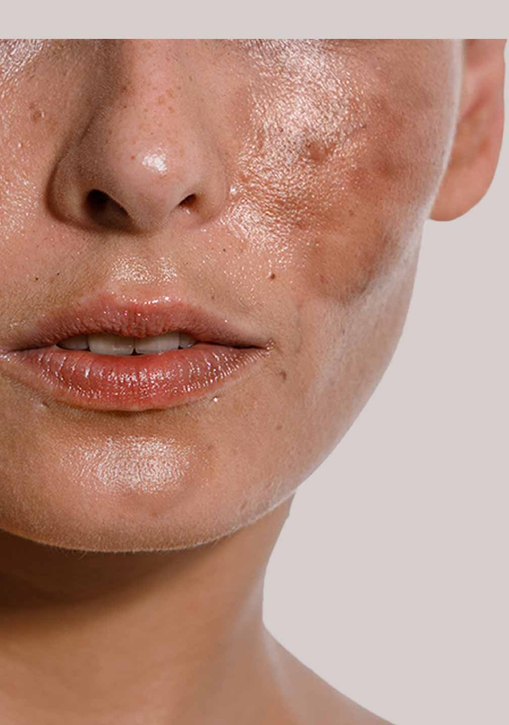 Nahaufnahme eines menschlichen Gesichts mit unebener Hauttextur, passend zur RAU Cosmetics Whitening & Brightening Cream.