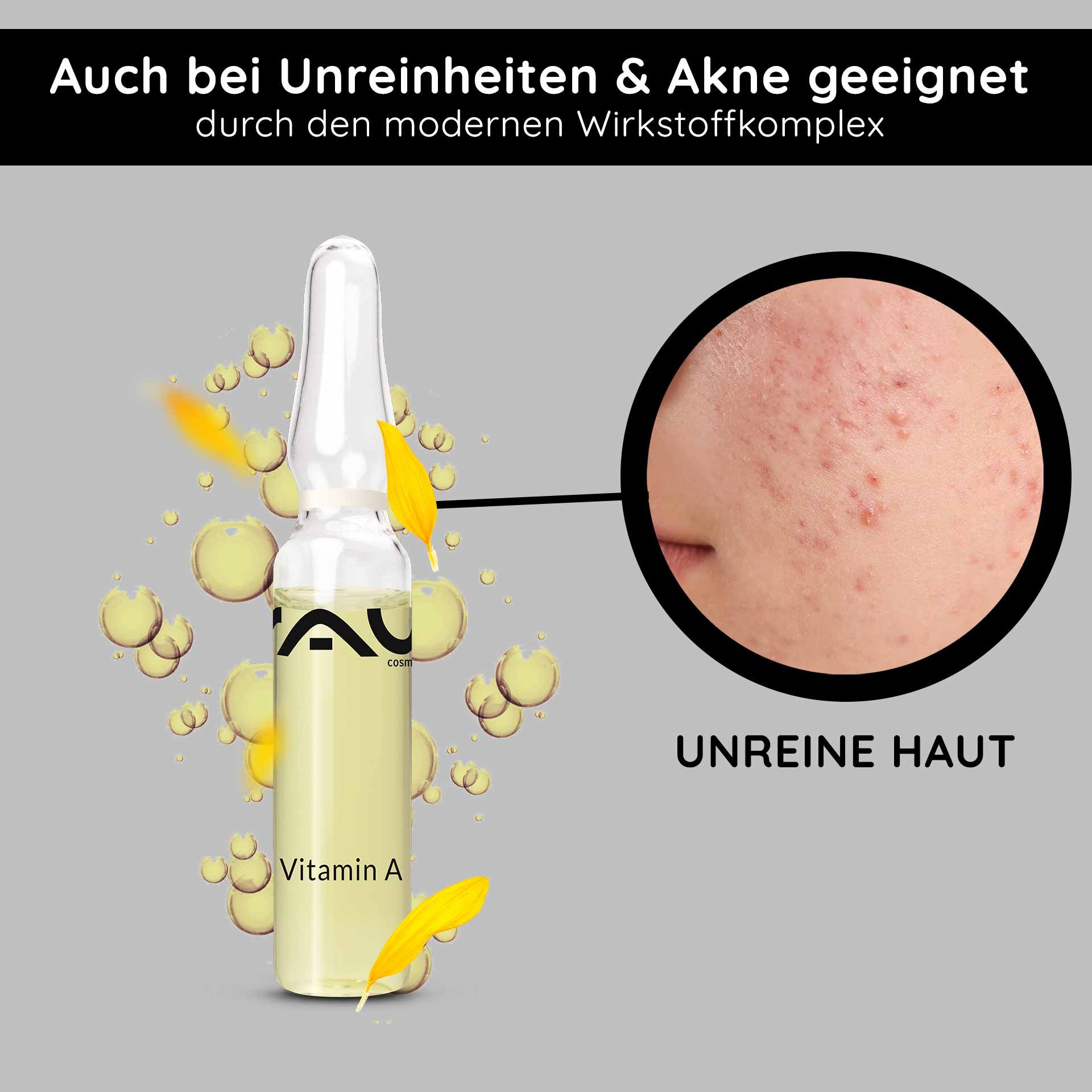 Ampoule de vitamine A de RAU Cosmetics, mise en avant pour l'acné et les imperfections, avec un gros plan de la peau impure, entourée de bulles et de pétales de fleurs, soulignant le complexe de principes actifs moderne.
