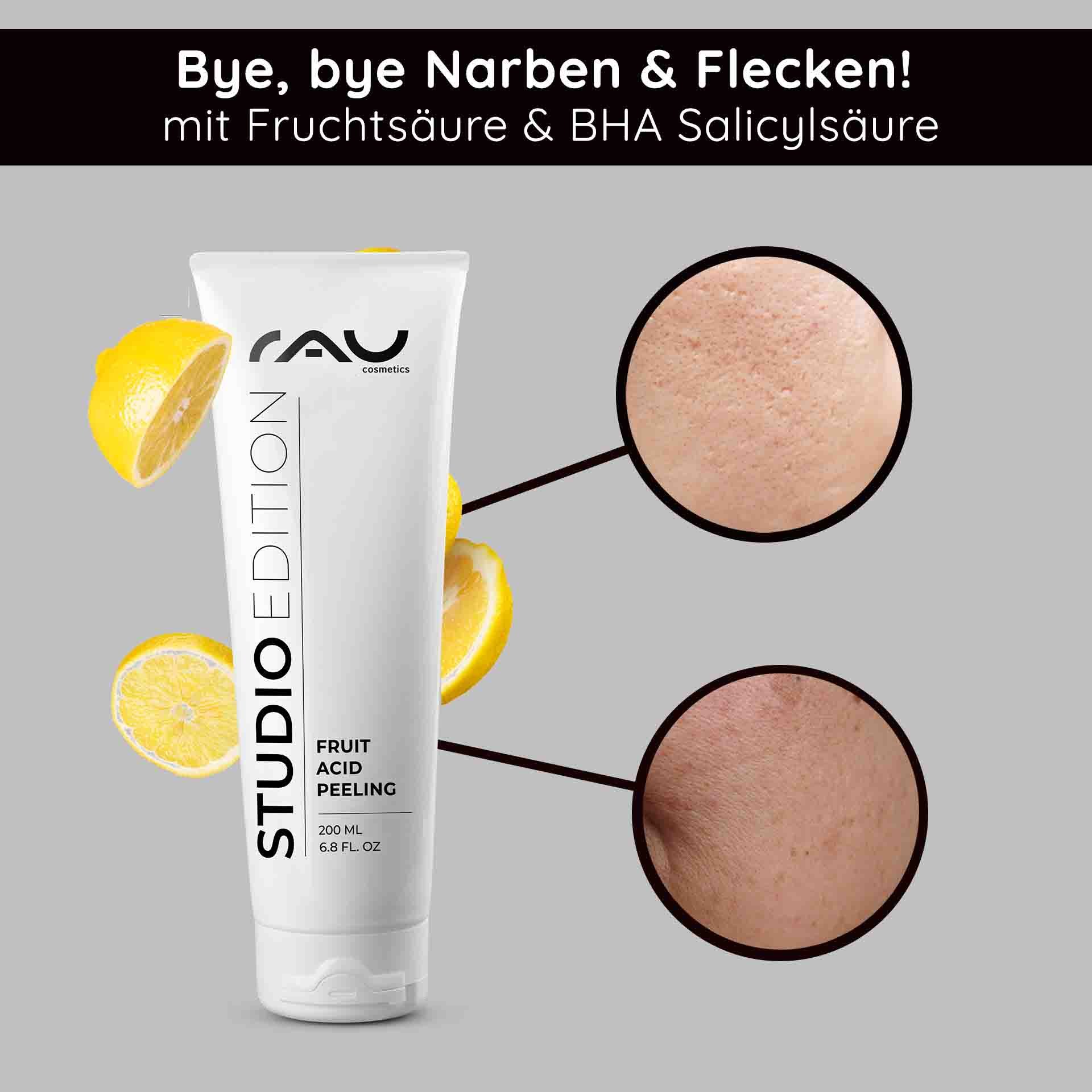 RAU Cosmetics Fruit Acid Peeling-Tube mit Zitronenscheiben, das die Verbesserung der Hautstruktur und die Vorteile von BHA-Salicylsäure zur Reduzierung von Narben und Hautunreinheiten hervorhebt.