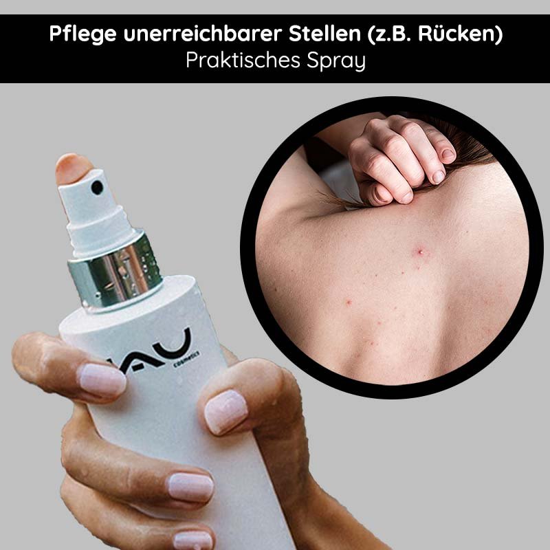 Nahaufnahme einer Hand, die die VAU Silver Face & Body Spray Flasche hält, zeigt Hautunreinheiten am Rücken.