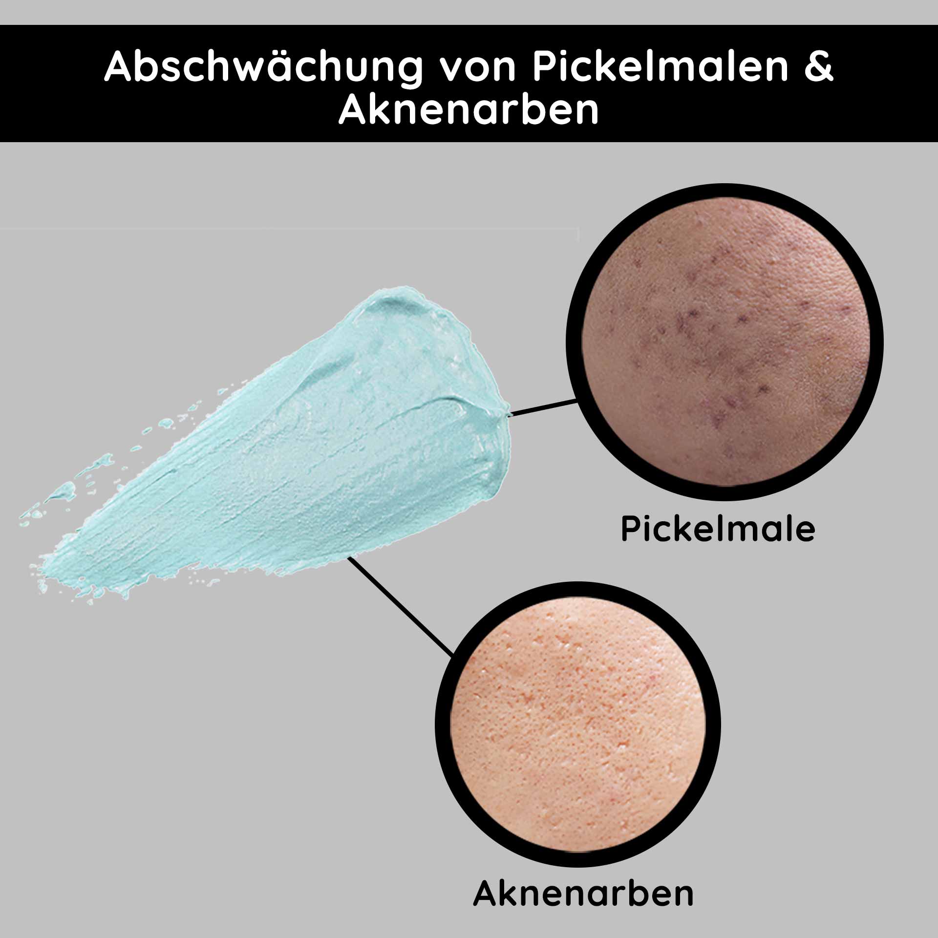 O2 Rich Cream 200 ml Reichhaltig & duftend Abschwächung von Pickelmalen und Aknenarben mit blauer Creme, Vergleich von Hauttexturen für Hautpflegeprodukte.