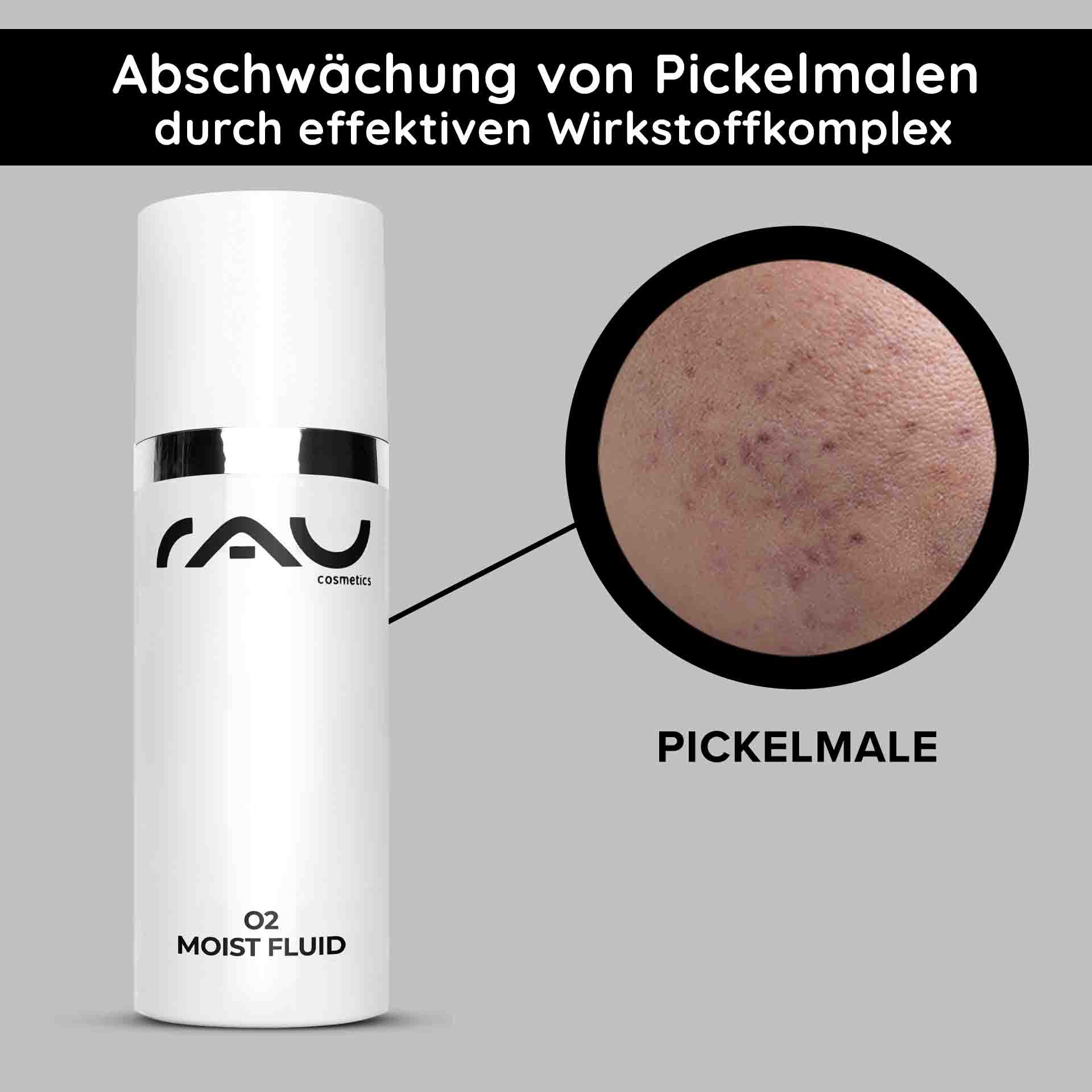 RAU O2 Moist Fluid Hautpflegeprodukt mit sichtbarem Etikett und Nahaufnahme der Haut mit Aknenarben, wobei die Vorteile für fahle Haut und die Aknebehandlung hervorgehoben werden.