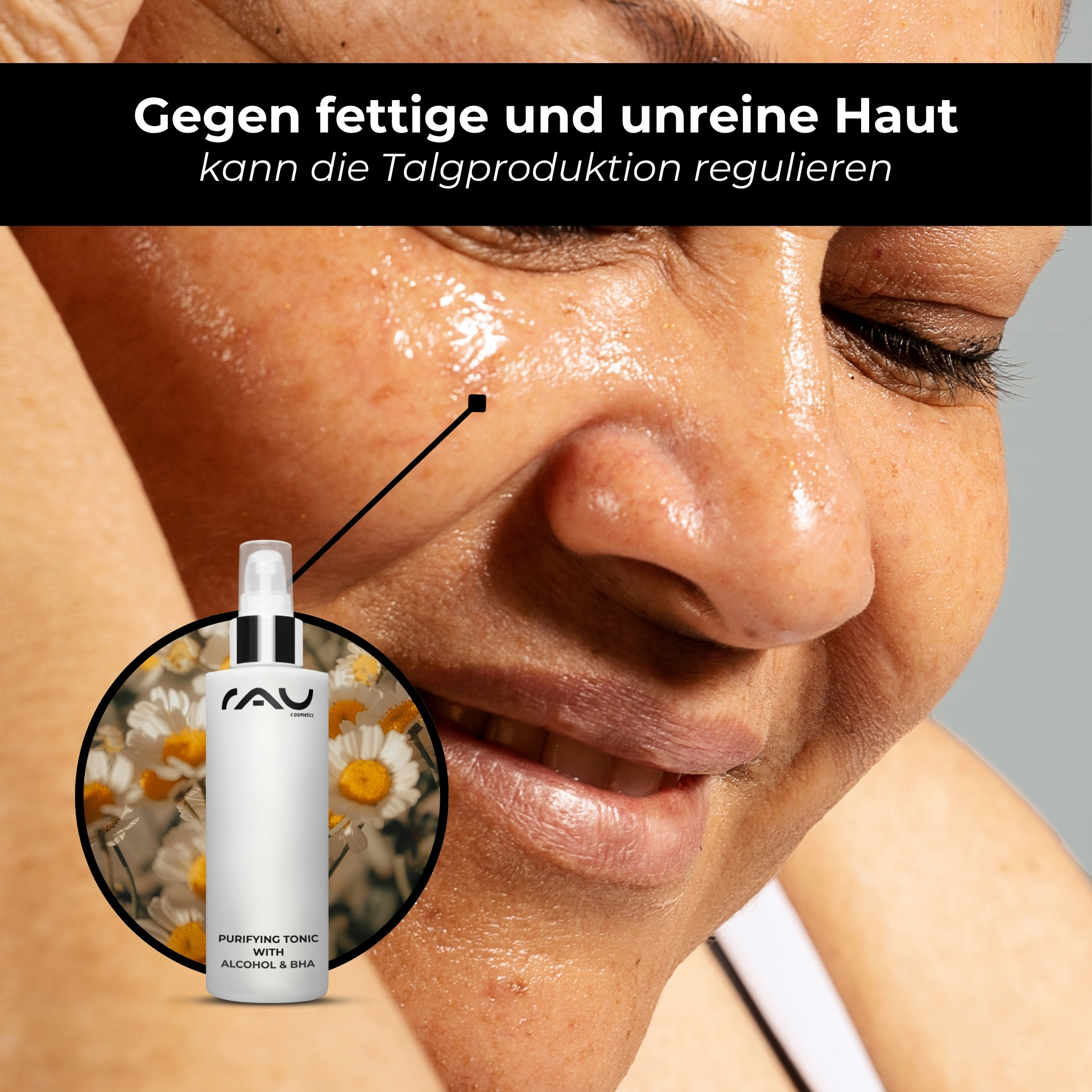 Purifying Tonic with alcohol 200 ml against impure skin Kopf, Person, Gesicht, Erwachsener, Frau