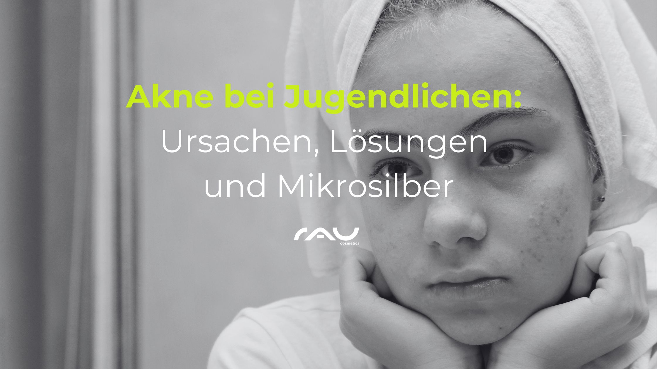 Akne bei Jugendlichen Akne bei Jugendlichen: Junge mit sichtbaren Pickeln und nachdenklichem Ausdruck, betont die Herausforderungen von Akne und Lösungen wie Mikrosilber in der Hautpflege.