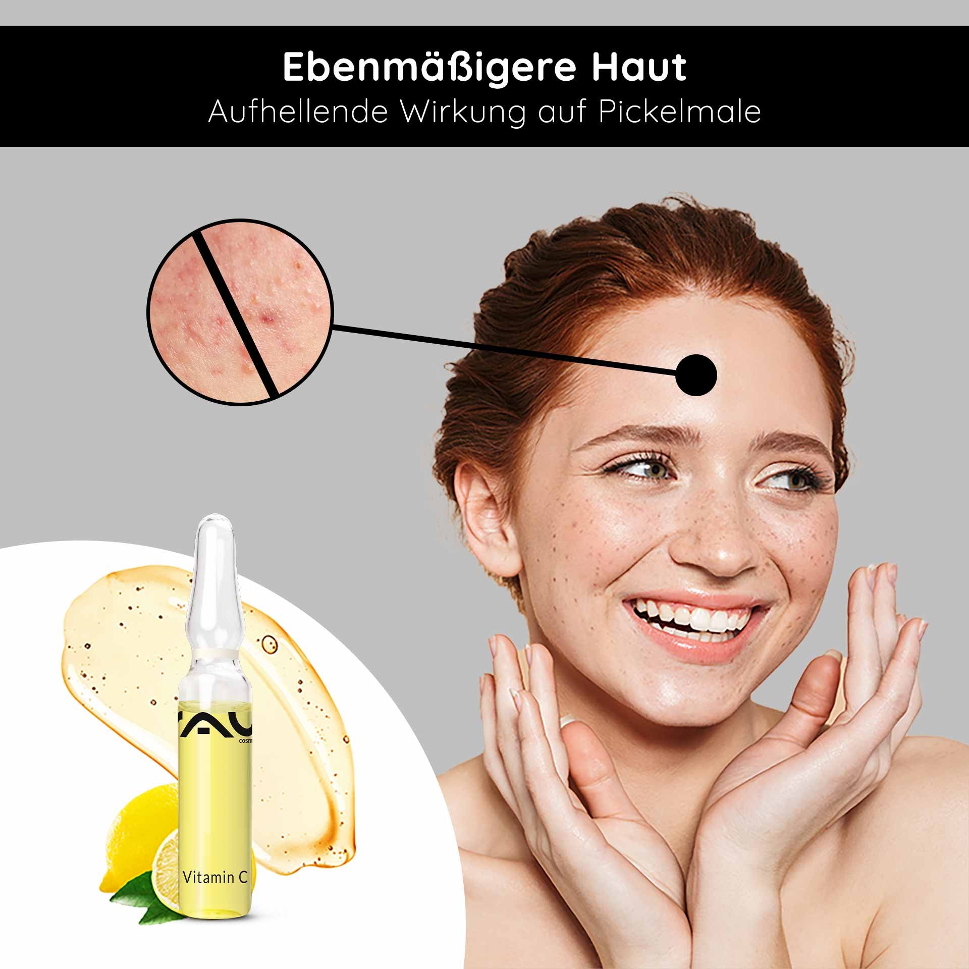 Vitamin C Ampullen von RAU Cosmetics, lächelnde Frau mit strahlender Haut, Hautunreinheiten im Fokus, aufhellende Wirkung, frische Zitrone und Serum abgebildet.